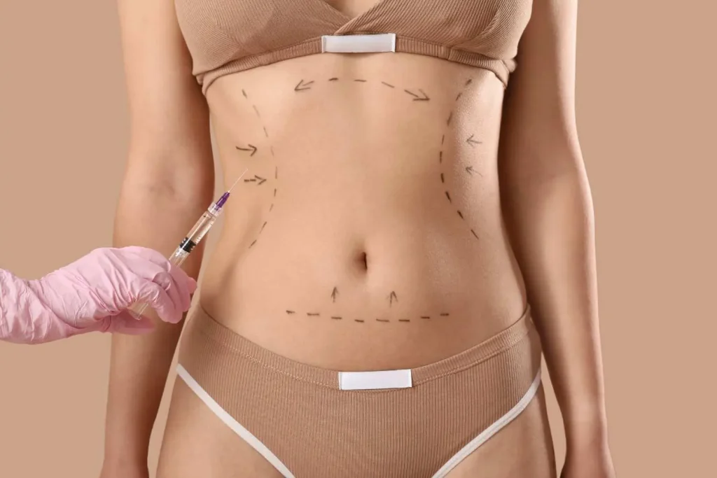 360-liposuction-targeted-treatment