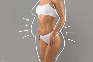 fat-reduction-with-vaser-liposuction