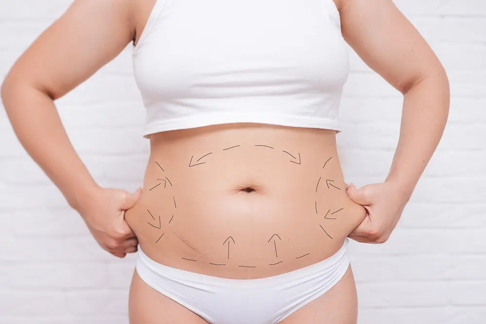 role-of-skin-elasticity-in-fat-reduction