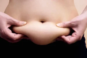 stubborn-fat-removal