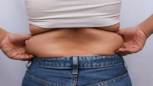 liposuction-for-love-handles