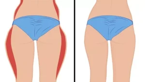 saddlebag-fat