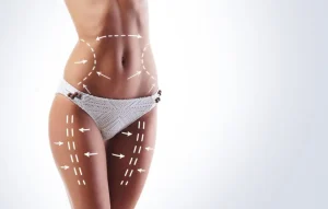 vaser-liposuction-areas