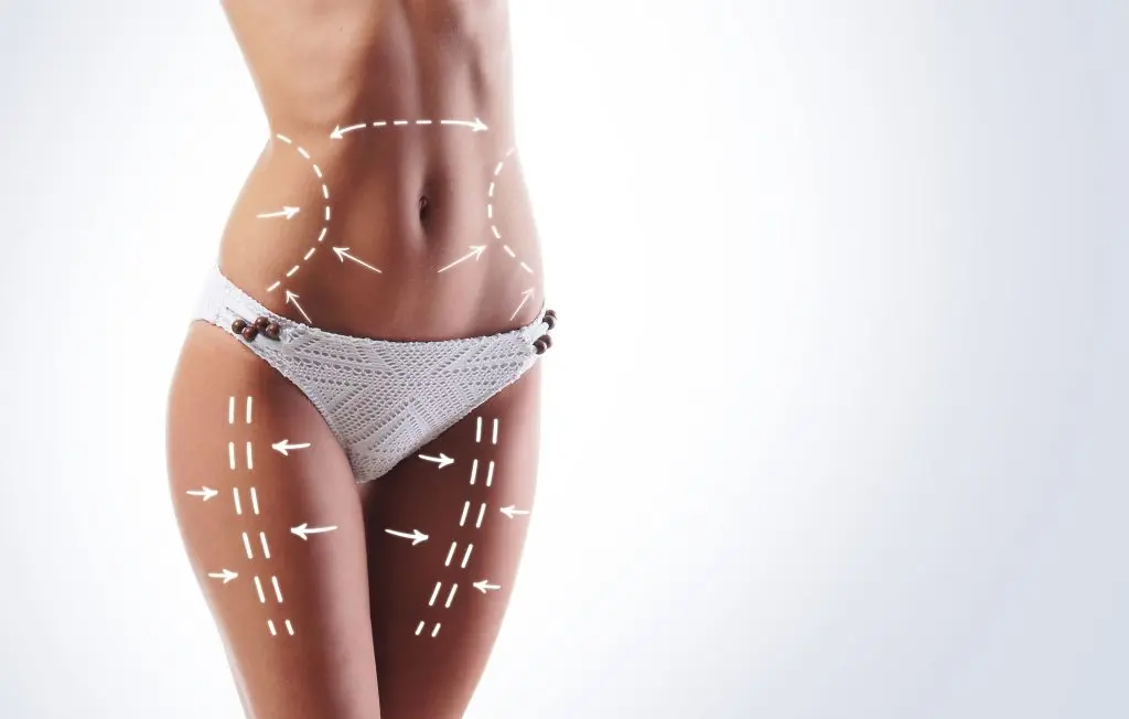 What Areas Can Be Treated with VASER Liposuction?