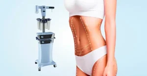 How Does VASER Liposuction Sculpt the Waist?