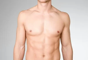 Can Liposuction Reduce Male Chest Fat? Understanding Male Chest Contouring